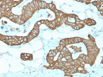 Recombinant KRT19 Antibody / Rabbit Monoclonal