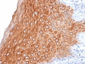 Recombinant Keratin 16 Antibody / Rabbit Monoclonal