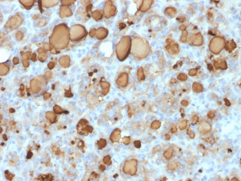 Recombinant TG Antibody / Thyroglobulin