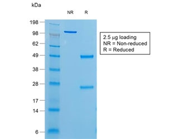 Recombinant TG Antibody / Thyroglobulin