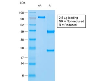Recombinant Napsin A Antibody / Rabbit Monoclonal