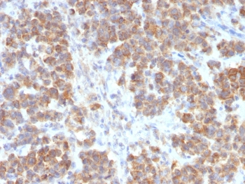 Recombinant TNFSF15 Antibody / TL1A / VEGI