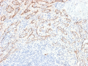 Recombinant TNFSF15 Antibody / TL1A / VEGI