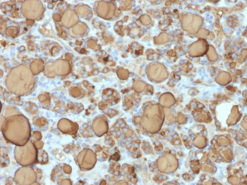 Recombinant Thyroglobulin Antibody / Rabbit Monoclonal
