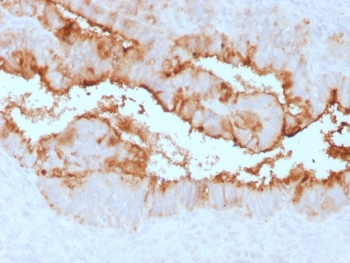 Recombinant MUC16 Antibody / Rabbit Monoclonal
