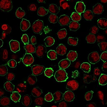 Recombinant CD43 Antibody / Rabbit Monoclonal
