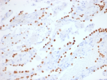 Recombinant NKX2.1 Antibody / TTF-1 Rabbit Monoclonal
