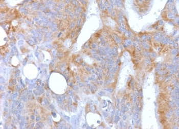 Recombinant CD86 Antibody / Rabbit Monoclonal