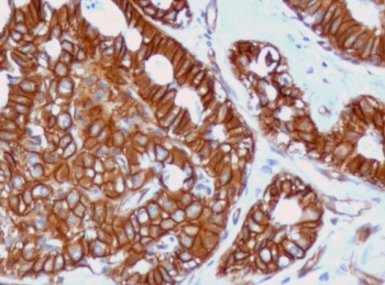 Recombinant Beta Catenin Antibody / Rabbit Monoclonal