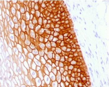 Recombinant CD44v4 Antibody / Rabbit Monoclonal