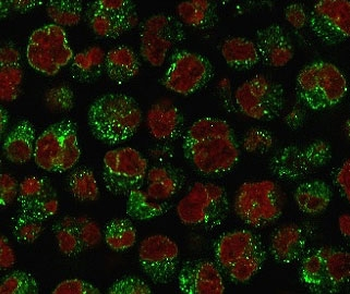 Recombinant CD79a Antibody / Rabbit Monoclonal