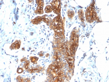 Recombinant Mucin-1 Antibody / Rabbit Monoclonal