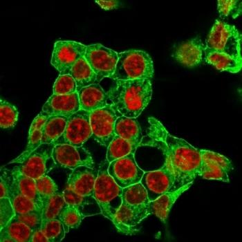Recombinant GPC3 Antibody / Glypican-3