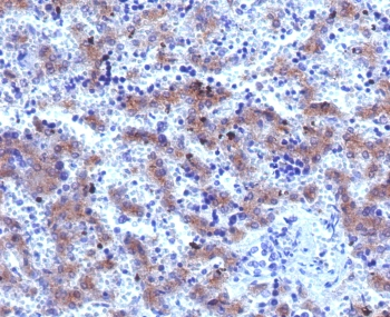 Recombinant Glypican 3 Antibody / GPC3 / Rabbit Monoclonal