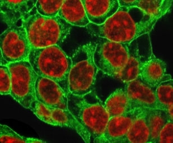 Recombinant Glypican 3 Antibody / GPC3 / Rabbit Monoclonal