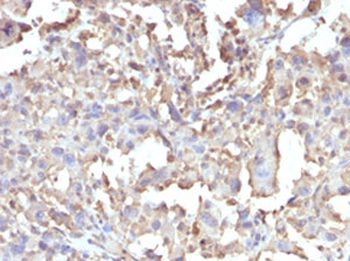 Recombinant TNFa Antibody / Rabbit Monoclonal