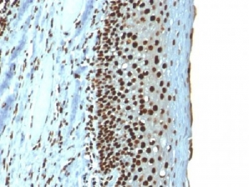 Recombinant Histone H1 Antibody