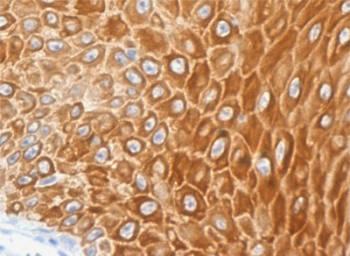 Recombinant Cytokeratin 16 Antibody / Rabbit Monoclonal