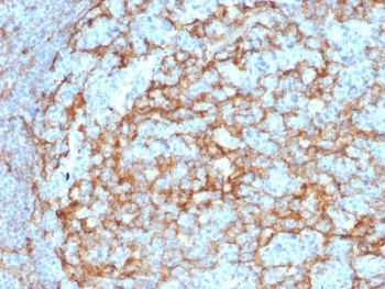 CD14 Antibody (Macrophage Marker)
