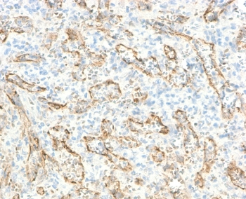Recombinant VEGI Antibody / TL1A / TNFSF15