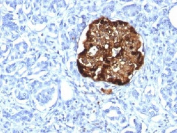Recombinant Chromogranin A Antibody / Rabbit Monoclonal