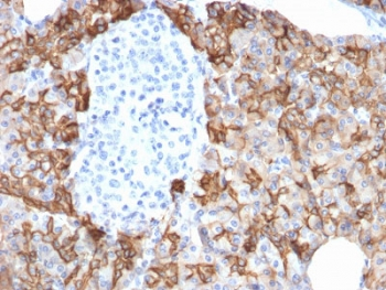 TROP2 Antibody / TACSTD2
