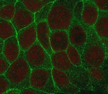 TROP2 Antibody / TACSTD2