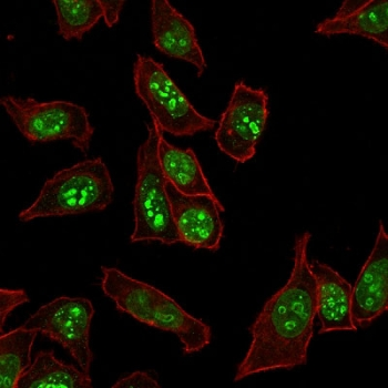 Ki-67 Antibody