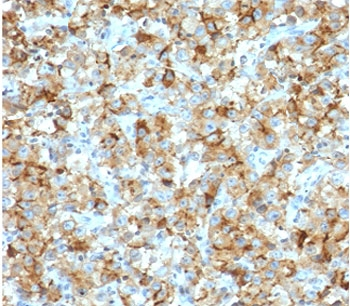 StAR Antibody / Steroidogenic acute regulatory protein