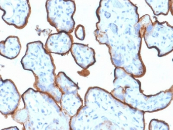 Transferrin Receptor Antibody / CD71 (Extracellular domain)