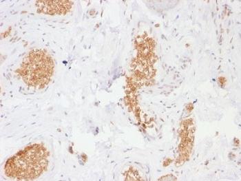 GLUT1 Antibody