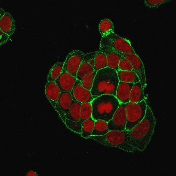 GLUT1 Antibody