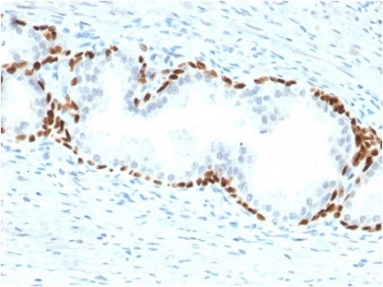 p63 Antibody