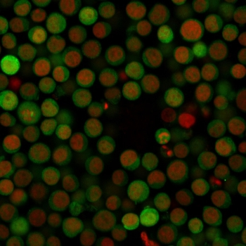 PD-L1 Antibody / B7-H1 / CD274