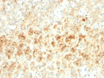 Recombinant Adipophilin Antibody / ADRP / Perilipin 2 / PLIN2