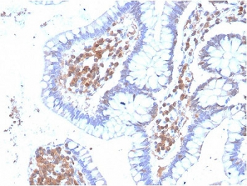 MAPK14 Antibody / p38 MAPK