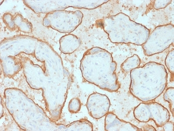 Recombinant EGFRvIII Antibody / EGF Receptor Variant III