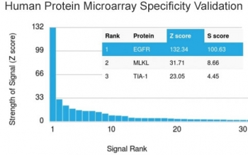 Recombinant EGF Receptor Antibody