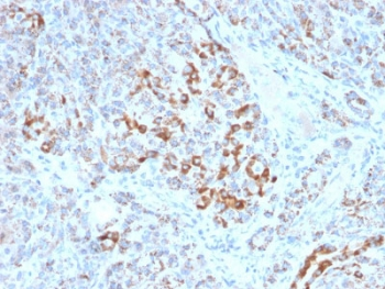 FXN Antibody / Frataxin