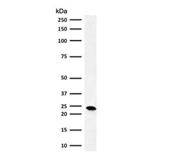 Bcl2 Antibody