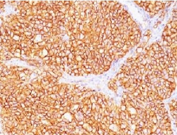 CAIX Antibody / Carbonic Anhydrase IX