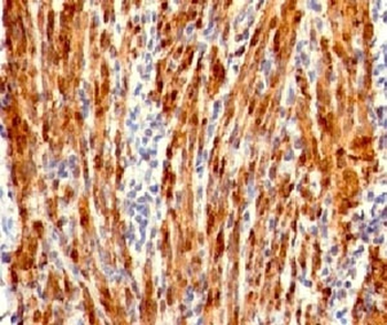 Recombinant Calponin Antibody / Rabbit Monoclonal