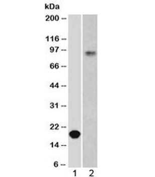 E-Cadherin Antibody / CDH1