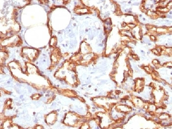 Recombinant CD31 Antibody / Rabbit Monoclonal