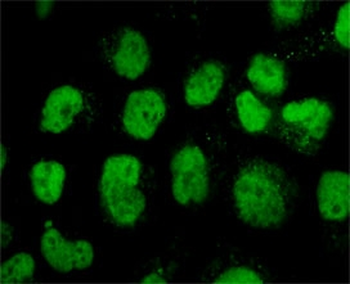 TOP2A Antibody / Topoisomerase II alpha