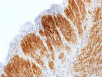 Recombinant Calponin Antibody / Rabbit Monoclonal