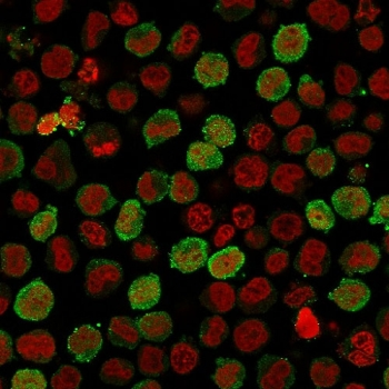 Recombinant Calponin Antibody / Rabbit Monoclonal