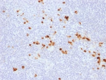 Recombinant IgG Antibody / Rabbit Monoclonal