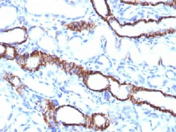Recombinant Cadherin 16 Antibody / Rabbit Monoclonal