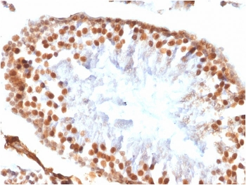Recombinant WT1 Antibody / Rabbit Monoclonal